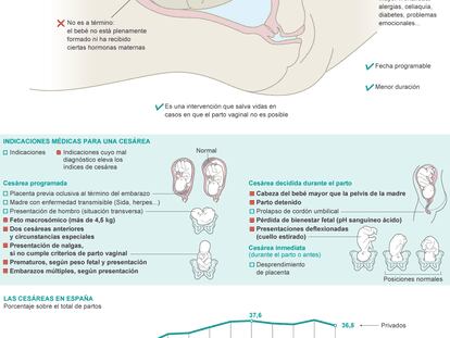 Recomendaciones Para Un Parto Normal Ciencia El Pa S