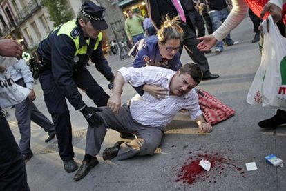 El transeúnte herido en el ojo izquierdo, caído en el suelo tras recibir el disparo de un policía municipal en la Puerta del Sol.