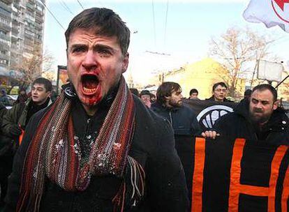 Un manifestante ruso, tras ser golpeado por partidarios del Gobierno en Moscú.