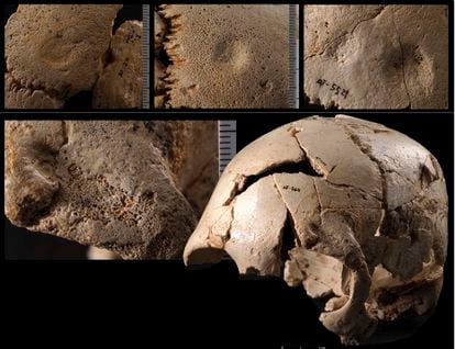 Varias de las heridas cicatrizadas encontradas en los cráneos de la Sima de los Huesos de Atapuerca.