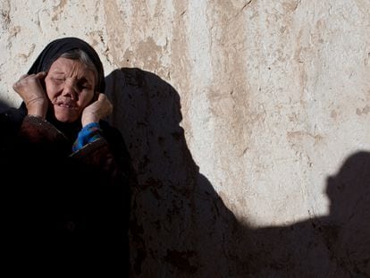Una mujer con lepra avanzada, en un centro médico de Yawlang, Afganistán, en 2010.