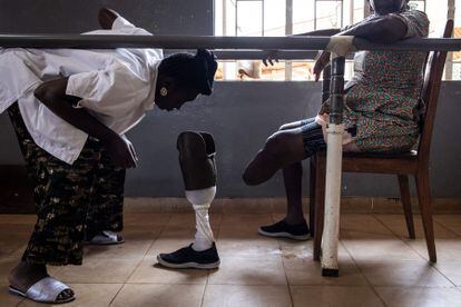 Una mujer espera a que le coloquen una nueva prótesis de pierna en el Centro Nacional de Rehabilitación Física de Freetown el 20 de abril de 2022. 