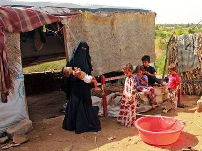 Hashem Mahmoud Atin, un niño yemení desplazado de diez meses que sufre de desnutrición aguda y que no puede llegar a un hospital para recibir tratamiento, es retenido por su madre en un campamento en Abs, en la provincia de Hajjah, en el norte de Yemen, el 3 de septiembre de 2020. Cientos de niños y mujeres embarazadas se han visto afectados negativamente por el cierre de clínicas médicas financiadas por el Fondo de las Naciones Unidas para la Infancia (UNICEF) en los campamentos de desplazados de Yemen.