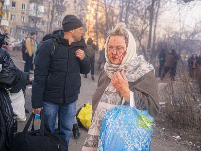 Una mujer herida camina durante la evacuación de un bloque de viviendas en Kiev. El papa denunció, en referencia a la guerra en Ucrania por la invasión de Rusia, que "la Humanidad se ve amenazada por un perverso abuso del poder" que está condenando "a personas indefensas a una violencia brutal".