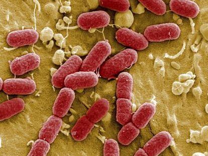 Colonia de Escherichia coli, una bacteria fecal.