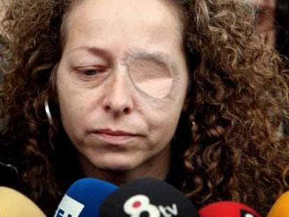 Ester Quintana, 42 a&ntilde;os, perdi&oacute; un ojo el 14-N tras una manifestaci&oacute;n. 