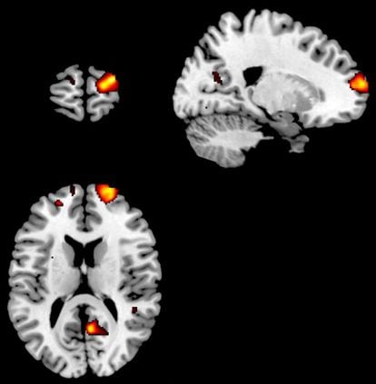 Imágenes de escáner que muestran la localización de la materia gris activada cuando pensamos en nuestros pensamientos