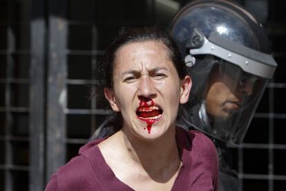 Una joven manifestante herida durante los choques con la policía.