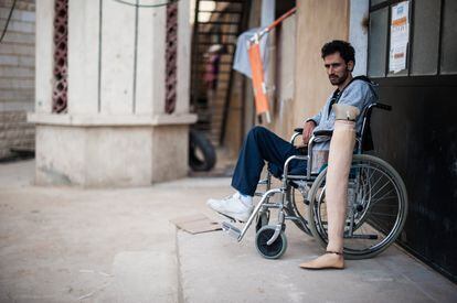 Varios jóvenes combatientes sirios insurrectos reciben prótesis en el hospital informal de Arsal, en abril de 2014 tras perder alguna extremidad en los combates en Siria