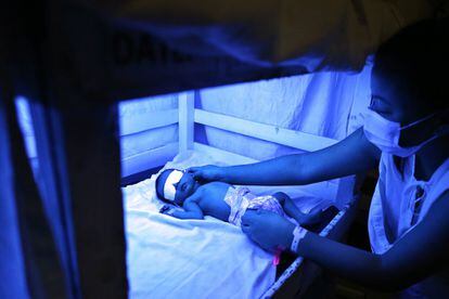 Una madre expone a su hijo a la luz ultravioleta en un rústico equipo construido con madera en el hospital Jose Fabella de Manila.