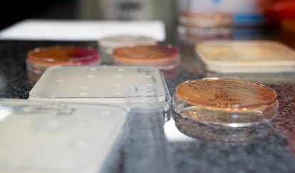 Laboratorio de microbiología del hospital de MSF en Amán en el que se analiza la resistencia a los antibióticos de algunas bacterias. 