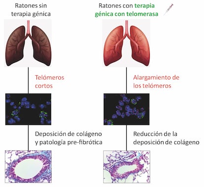 Desarrollo de los estadios iniciales de fibrosis pulmonar asociada al envejecimiento en ratones sin tratar (izquierda.), que se previene en ratones tratados con la terapia génica en telomerasa (derecha).