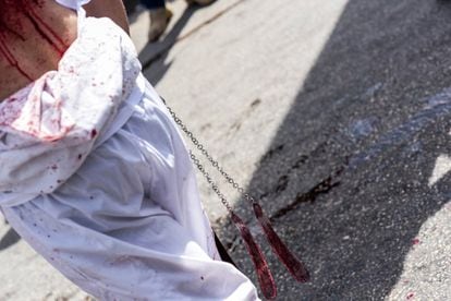 Entre la masa negra de penitentes, varios centenares de personas visten de blanco y branden sables que alzan al cielo antes de golpearse la cabeza. Un reguero de sangre recorre sus rostros y pechos. En uno de los laterales de la plaza aguardan unos cuantos hombres botella de agua oxigenada en el bolsillo y navaja en mano. Aplican un generoso chorro sobre las afiladas cuchillas que parece bastarles por toda esterilización. Con un hábil y rápido movimiento de muñeca aporrean el centro de la cabeza del penitente haciendo una pequeña incisión. El resto ya depende del fervor de cada cual. Los más prudentes o novatos se golpean la testa con las manos, pausando el vertido de sangre. Los jóvenes más impetuosos que lucen una miríada de cicatrices, recuerdos de previas Ashuras, se entregan a la sangría sin miramientos.