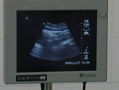El Gobierno incluirá la malformación fetal como motivo legal para abortar