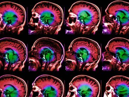 Investigadores de la Universidad de Columbia han descubierto un gen que tiene relación directa con el envejecimiento del cerebro.