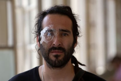César Callozo es trabajador de la construcción y cantante. Acudió a una revisión en un hospital en Santiago de Chile.