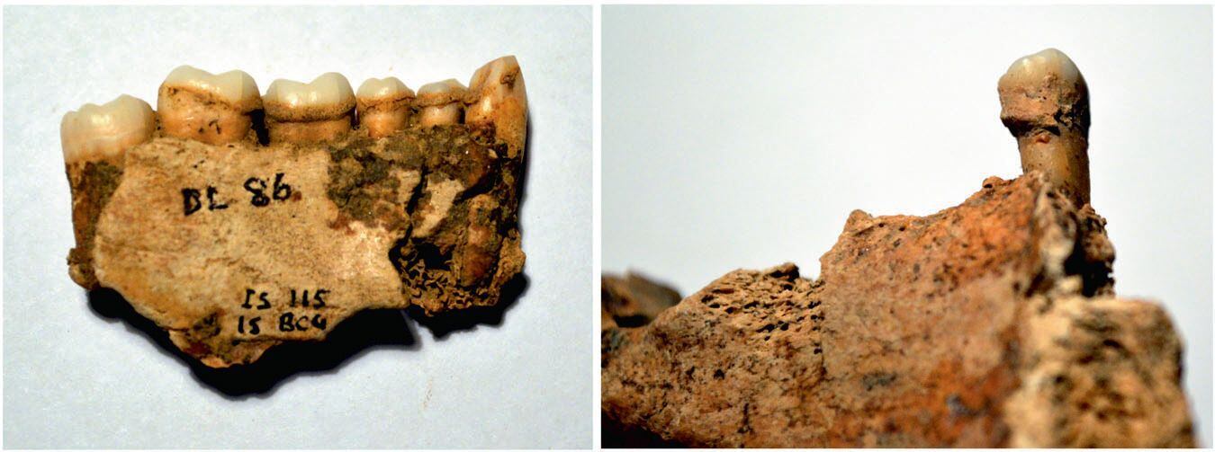 Dos de las muestras con sarro recuperadas de un yacimiento de las Orcadas, archipiélago al norte de Escocia, donde las algas se consumían desde hace unos 3.000 años.