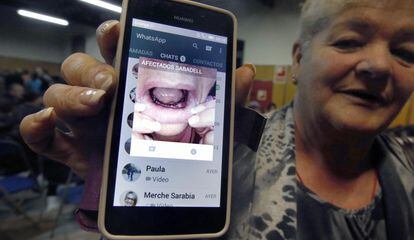 Josefa García mostra una fotografia de la seva boca sense dents després del tancament de Funnydent.