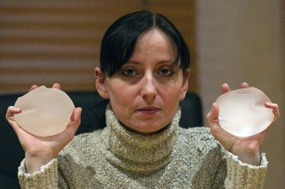 Alexandra Blach&eacute;re, fundadora de la asociaci&oacute;n de afectadas, muestra dos implantes defectuosos de la marca PIP.