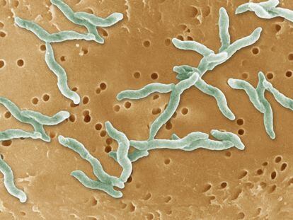 La bacteria 'Campylobacter jejuni', cuya presencia está asociada al síndrome Guillain-Barré.