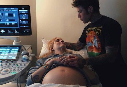 Fedez y Chiara Ferragni durante una ecografía.