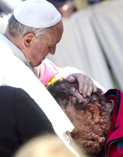 El papa Francisco, abraza a una persona enferma en la plaza de San Pedro del Vaticano tras presidir la audiencia general de los miércoles en Ciudad del Vaticano, 6 de noviembre de 2013.
