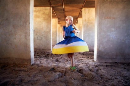 Kelen, de 11 años, en los dormitorios en construcción del centro para albinos de Kabanga, en Tanzania.