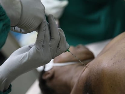 Extracción de tejido mediante una autopsia mínimamente invasiva.