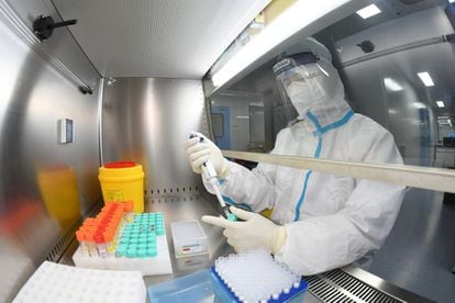 Un estudio revela la detección en dos provincias chinas de 35 contagios en humanos de un nuevo virus de origen animal del tipo Henipavirus. Los casos no presentan gravedad y los síntomas son parecidos a los del covid.