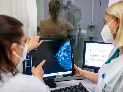 Dos sanitarias revisan la mamografía de una mujer.