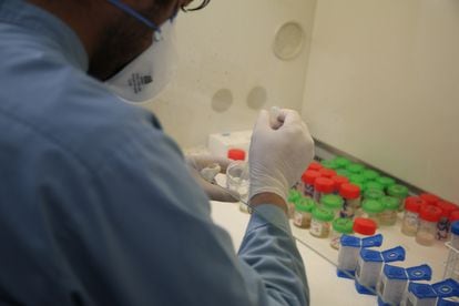 Un técnico de MSF analiza muestras en el laboratorio del hospital de tuberculosis farmacorresistente en Kandahar, Afganistán.