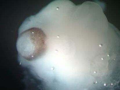 Imágenes del microcerebro con el desarrollo retinal.