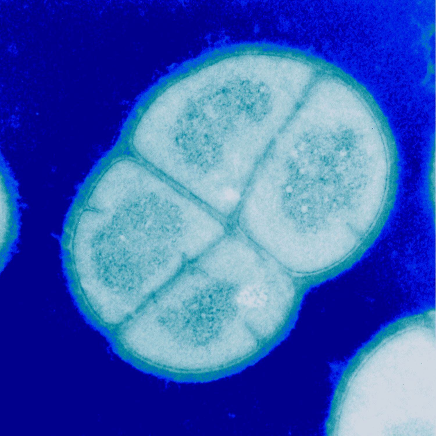 La 'Deinococcus radiodurans' esta siendo estudiada por los militares de EE UU por su resistencia a la radiación.