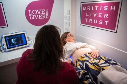 British Liver Trust