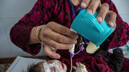 En Afganistán, Zakia, de un mes y medio, sufre de desnutrición aguda severa con complicaciones. Es alimentada por su madre con leche terapéutica a través de una sonda naso gástrica porque está demasiado enferma para amamantar.