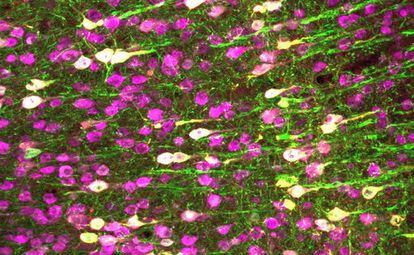 La imagen muestra neuronas cerebrales de un ratón, en magenta. Las de tonos blanquecinos son las que han expresado la proteína TRPA1, siendo sensibles a los ultrasonidos.
