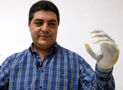 Lorenzo Gil Valía muestra su mano biónica