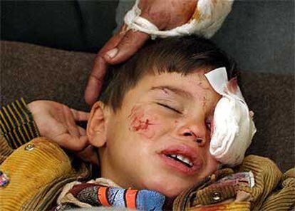 Un niño herido ayer en los ataques se recupera en el hospital de Kerbala.