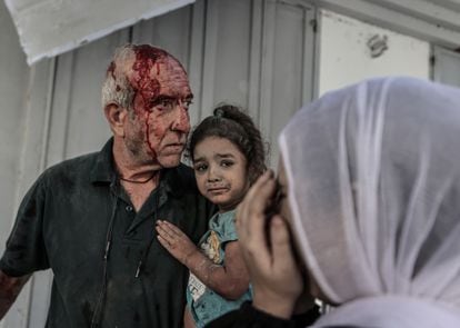 Un hombre herido, junto a una niña, tras las ataques israelíes en Gaza, este miércoles.