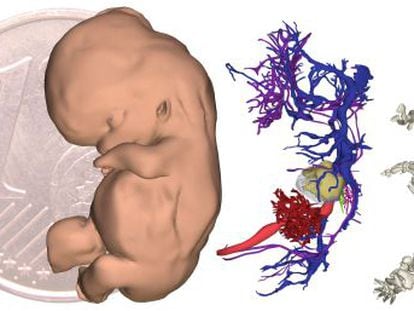 Un atlas 3D a partir de 15.000 rodajas embrionarias revela agujeros del conocimiento.