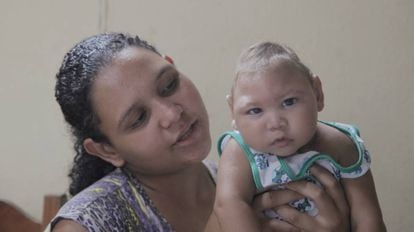 Ane Júliana Araújo y su hijo enfermo de zika.