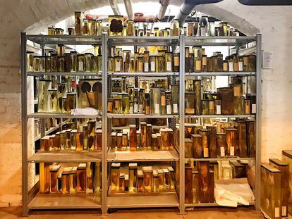 Colección de pulmones conservada en los sótanos del Museo de Historia de la Medicina Cahrité de Berlín.