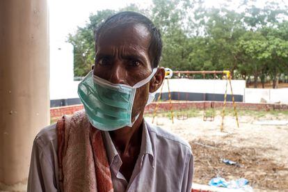 Deeplanaik, de 50 años, es seropositivo y sy padre le contagió la tuberculosis. Lleva un mes ingresado en el hospital de Bathalapalli. Se ha quedado en 35 kilos pero está evolucionando bien, según sus doctores. Antes trabajaba en el campo, y espera que volver a él cuando acabe el tratamiento.