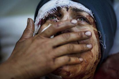 Aida, una joven de Idlib, se recupera de las heridas causadas durante un bombardeo del Ejército sirio. Su marido y dos de sus hijos murieron por un proyectil de las fuerzas pro-Asad que cayó en su casa.