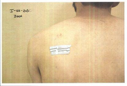 La marca de un golpe en la espalda perteneciente al archivo de imágenes revelado por el Pentágono en relación a las campañas de Irak y Afganistán