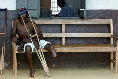 Un sierraleonés mutilado por la guerrilla del Frente Unido Revolucionario, en 1999.