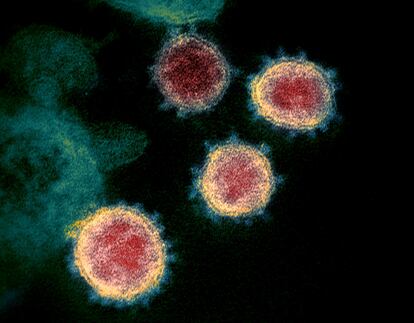 El virus SARS-CoV-2, aislado de un paciente en EE UU.