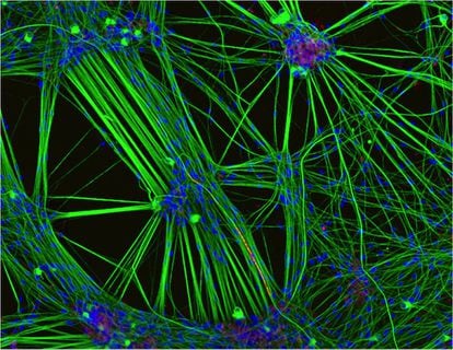 Cultivo de neuronas en una imagen de la Universidad de Oxford.