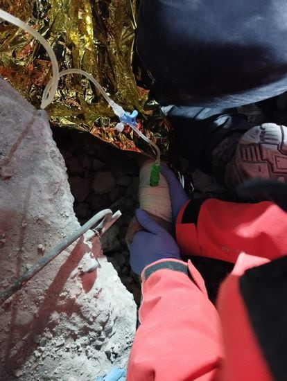 La mano de la mujer rescatada por la Unidad de Emergencia y Respuesta Inmediata de la Comunidad de Madrid (Ericam) después de siete días de que se produjera el terremoto en Turquía, con una vía intraósea puesta por sanitarios españoles. 