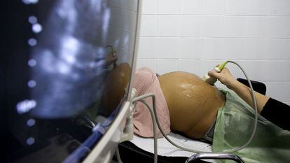 Una sanitaria realiza una ecografía a una embarazada en una consulta médica en Barcelona.